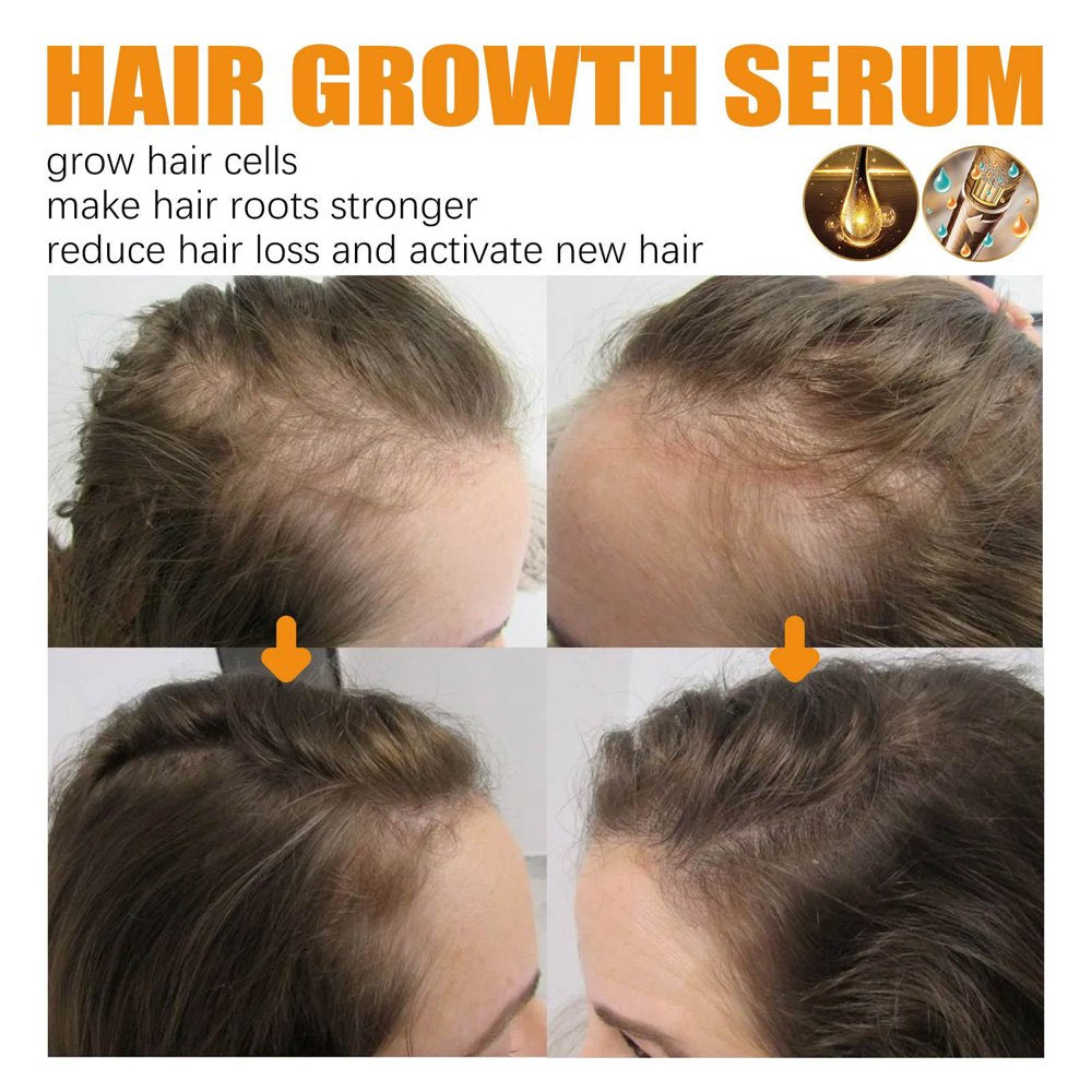 Hair Growth Products, Biotin, Fast Growing Hair Care, Essential Oil, Hair Loss Spray, Skin Nursing, 30Ml