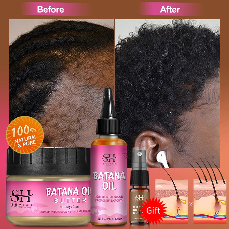 Fast Hair Growth Set Batana Oil Traction Alopecia Hair Mask anti Break Loss Hair Growth Oil Baldness Treatment Batana Essential